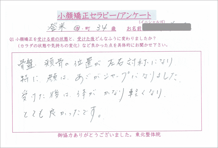 大崎市,小顔矯正ビフォーアフター