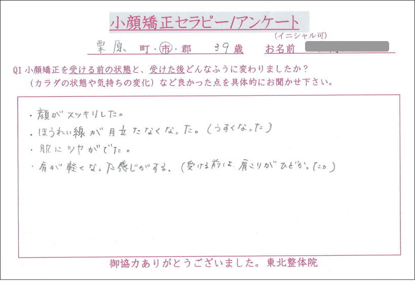 栗原市,小顔矯正ビフォーアフター