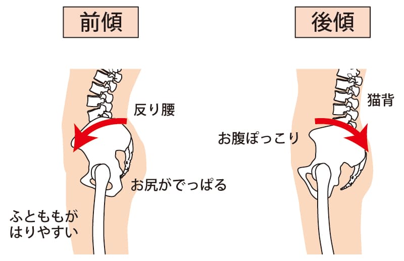 登米市,整体,反り腰